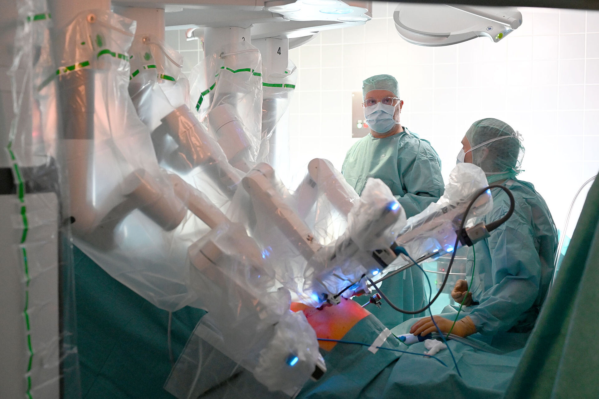 Schonende Operation bei Prostatakrebs mit dem DaVinci-System Minimalinvasiver Eingriff an der Prostata mit dem DaVinci-System. Durch die nur selten angewandte und besonders schonende Operationsmethode bleibt der Beckenboden unberührt und viele Risiken wie Inkontinenz und Impotenz werden gegenüber anderen Methoden von vornherein minimiert.