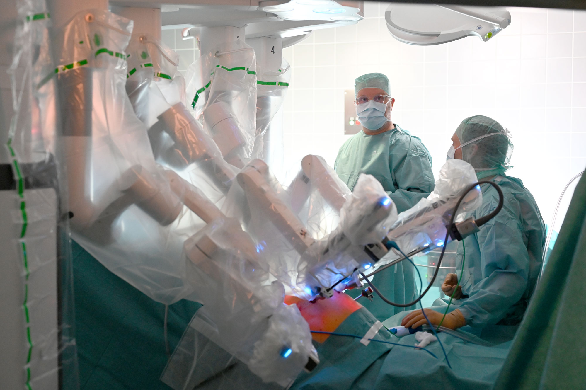 Schonende Operation bei Prostatakrebs mit dem DaVinci-System Minimalinvasiver Eingriff an der Prostata mit dem DaVinci-System. Durch die nur selten angewandte und besonders schonende Operationsmethode bleibt der Beckenboden unberührt und viele Risiken wie Inkontinenz und Impotenz werden gegenüber anderen Methoden von vornherein minimiert.