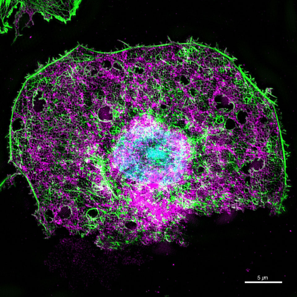 Höchstauflösende fluoreszenz-mikroskopische Aufnahme einer Leber-Endothelzelle (lila: Zellmembran, grün: Aktin-Zytoskelett, blau: Zellkern). Endothelzellen sind flache Zellen, die als eine einzige Schicht auf der Innenseite der Blutgefäße liegen. Bild: Universität Bielefeld/V. Mönkemöller, W. Hübner